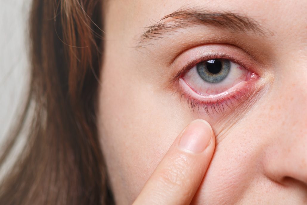Dry Eye Treatment and Comfort Care visual