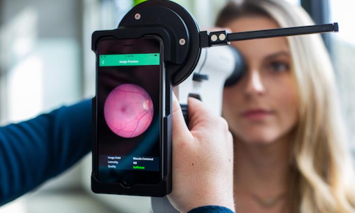 Retina Screening and Diabetic Eye Care visual